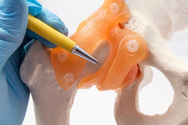 Photo of handing pointing to implant model with pen.