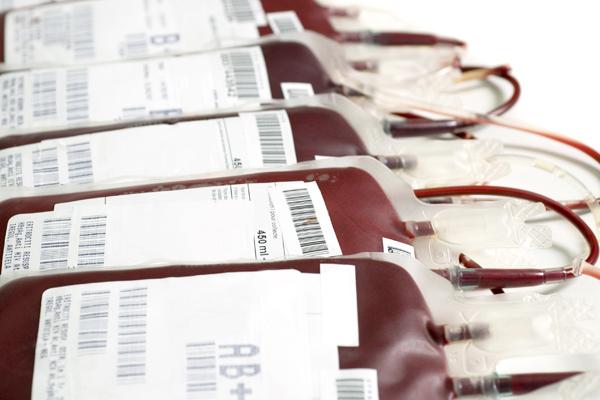 Photo of blood plasma bags.