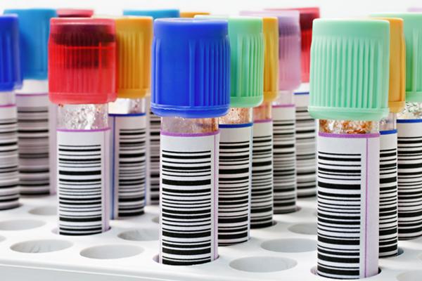 Photo of blood samples with bar codes.