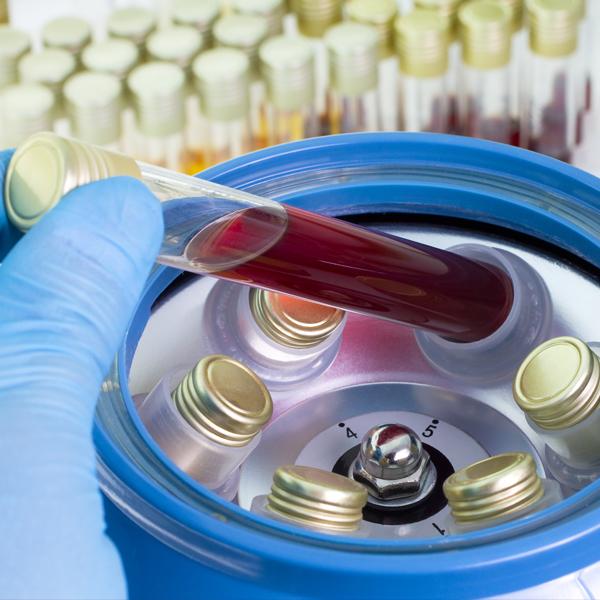 Photo of a vile of blood sample for testing.
