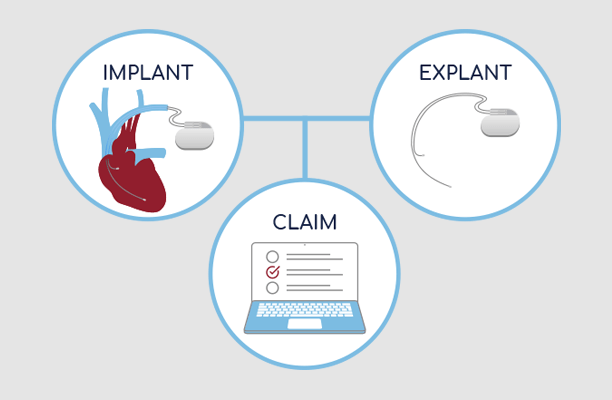 implant lifecycle