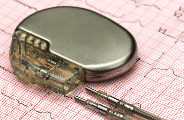 photo of a pacemaker