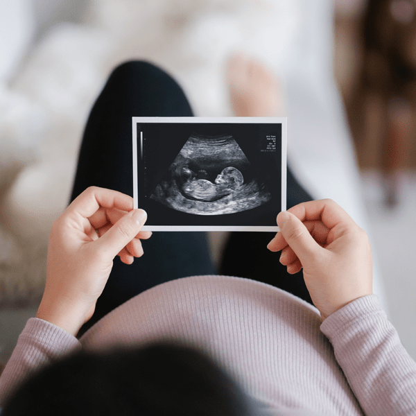 photo of mother holding ultrasound photo